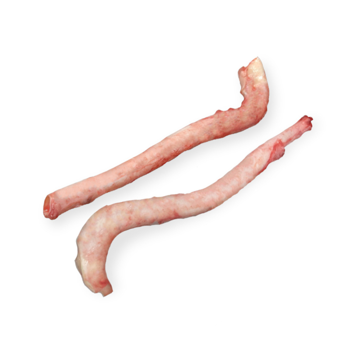 Aorta