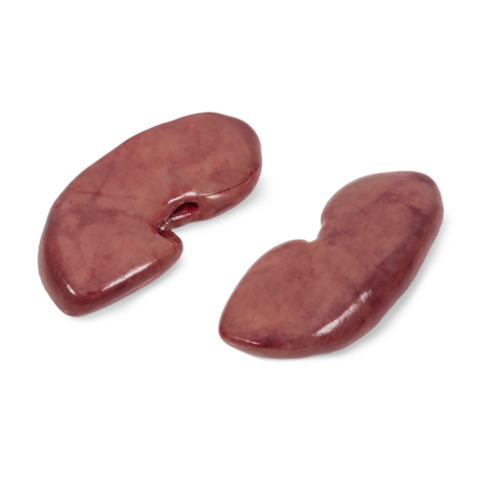 Riñones